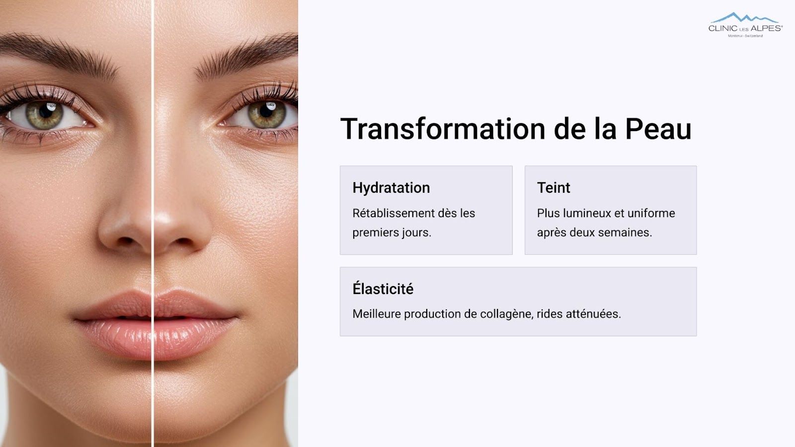 Transformation de la peau